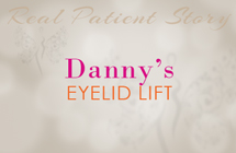danny-eyelid-lift