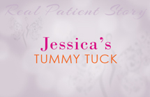 jessica-tummy-tuck