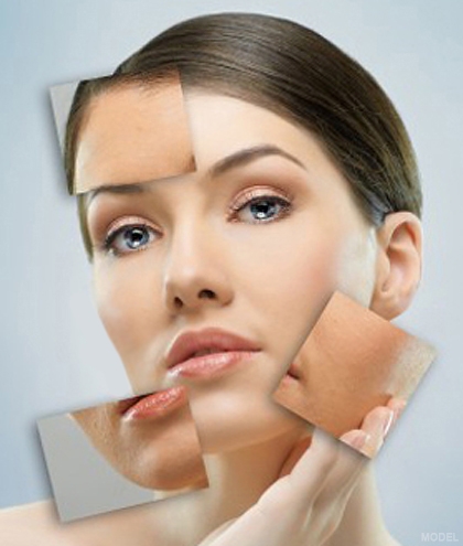 Micro Dermabrasion Skin Treatments in Pasadena and Inland Empire