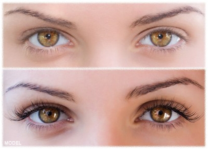Grow Eyelashes with Latisse in Pasadena and Inland Empire