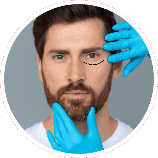 Facial Sculpting For Men