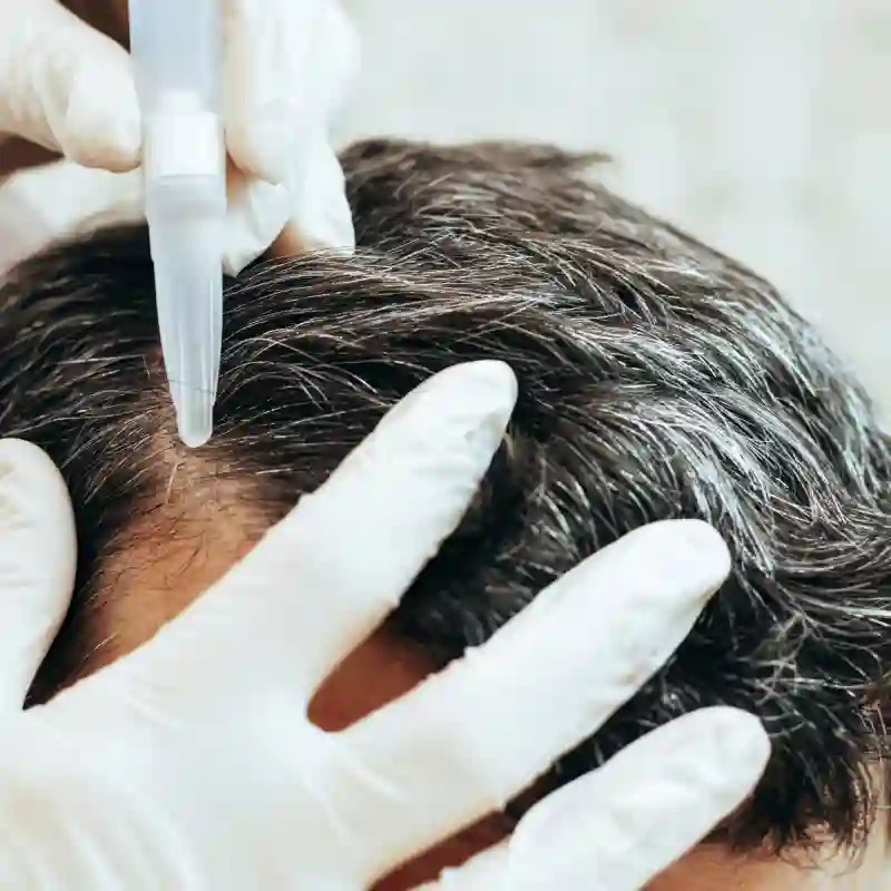 Hair Restoration