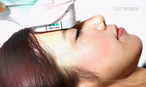 Ultherapy1