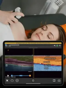 Ultrasound-Guided Aesthetics 1 Ultrasound Guided Breast Implant Removal